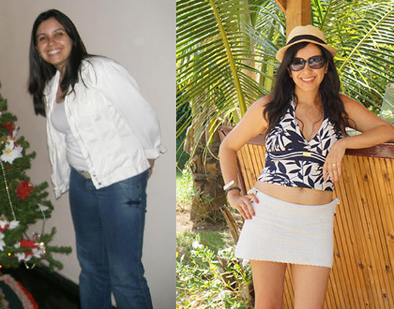 antes-depois